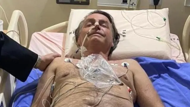 Bolsonaro hospitalizado tras someterse a procedimiento médico por hipo crónico mientras cumple condena de 27 años